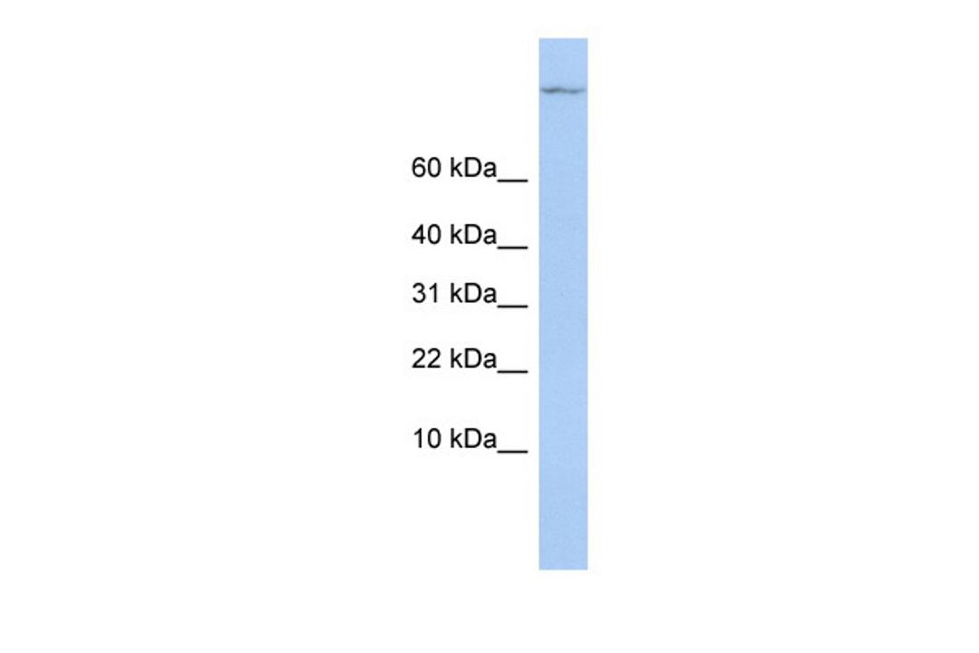 Antibody used in WB on Human MCF-7 at 0.2-1 ug/ml.