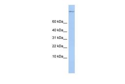 Antibody used in WB on Human MCF-7 at 0.2-1 ug/ml.