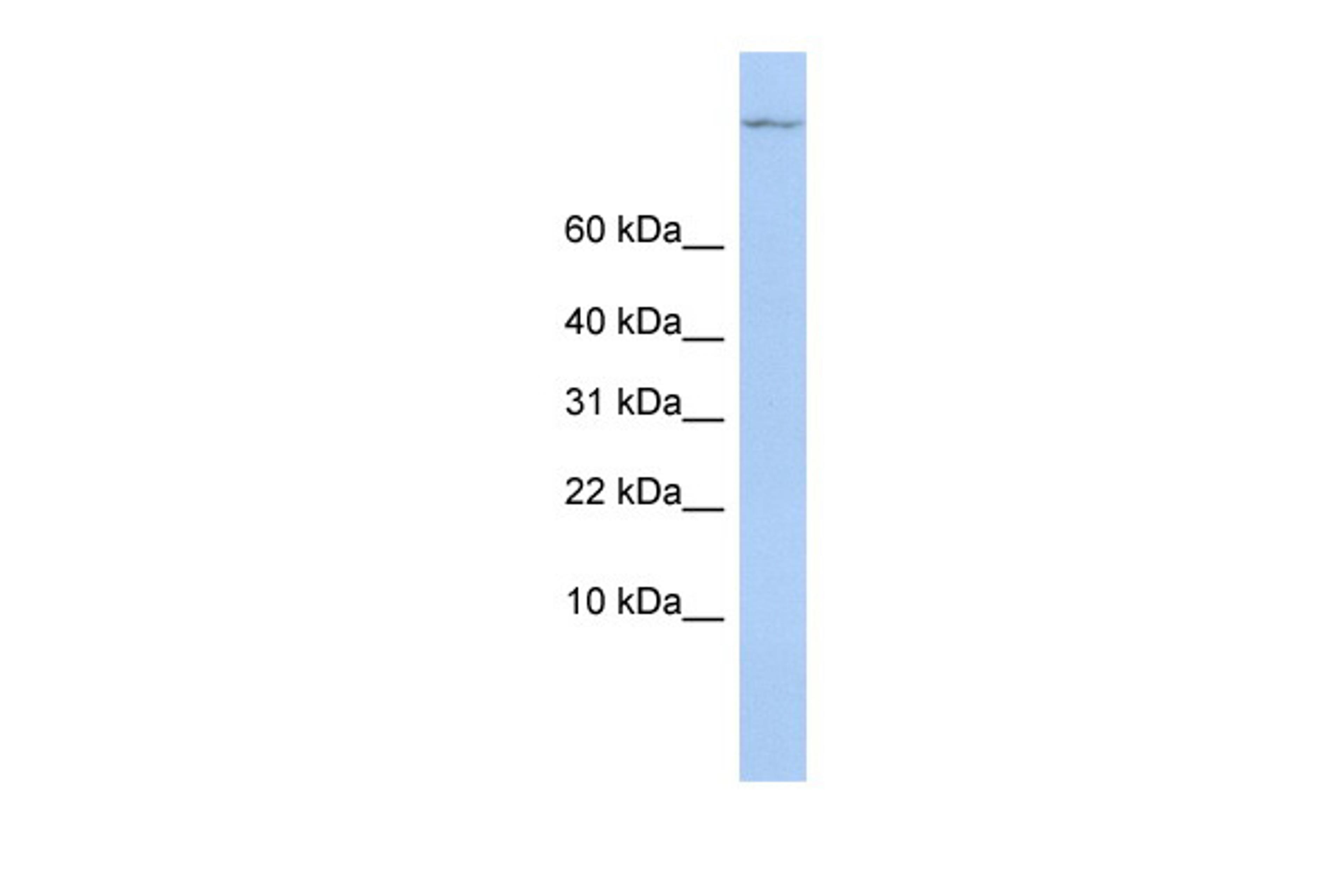 Antibody used in WB on Human MCF-7 at 0.2-1 ug/ml.