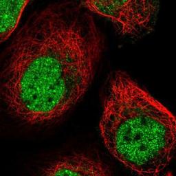 Immunocytochemistry/Immunofluorescence: Brk Antibody [NBP1-89935] Staining of human cell line A-431 shows positivity in nucleus but not nucleoli.