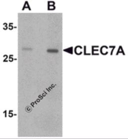 Western blot analysis of CLEC7A in rat spleen tissue lysate with CLEC7A antibody at (A) 1 and (B) 2 &#956;g/mL.