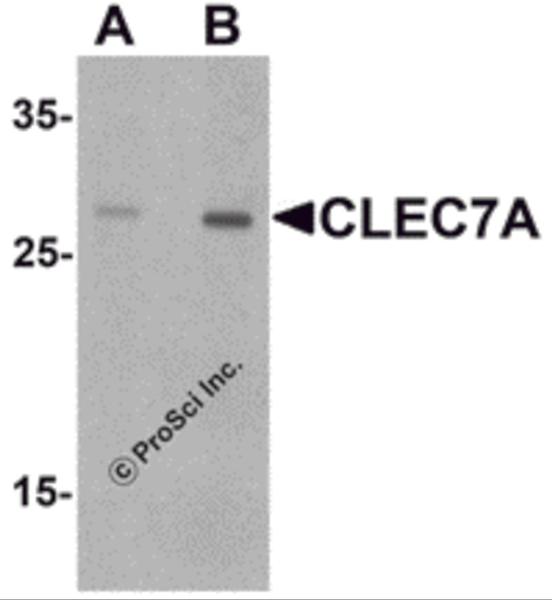 Western blot analysis of CLEC7A in rat spleen tissue lysate with CLEC7A antibody at (A) 1 and (B) 2 μg/mL.