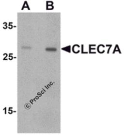 Western blot analysis of CLEC7A in rat spleen tissue lysate with CLEC7A antibody at (A) 1 and (B) 2 μg/mL.