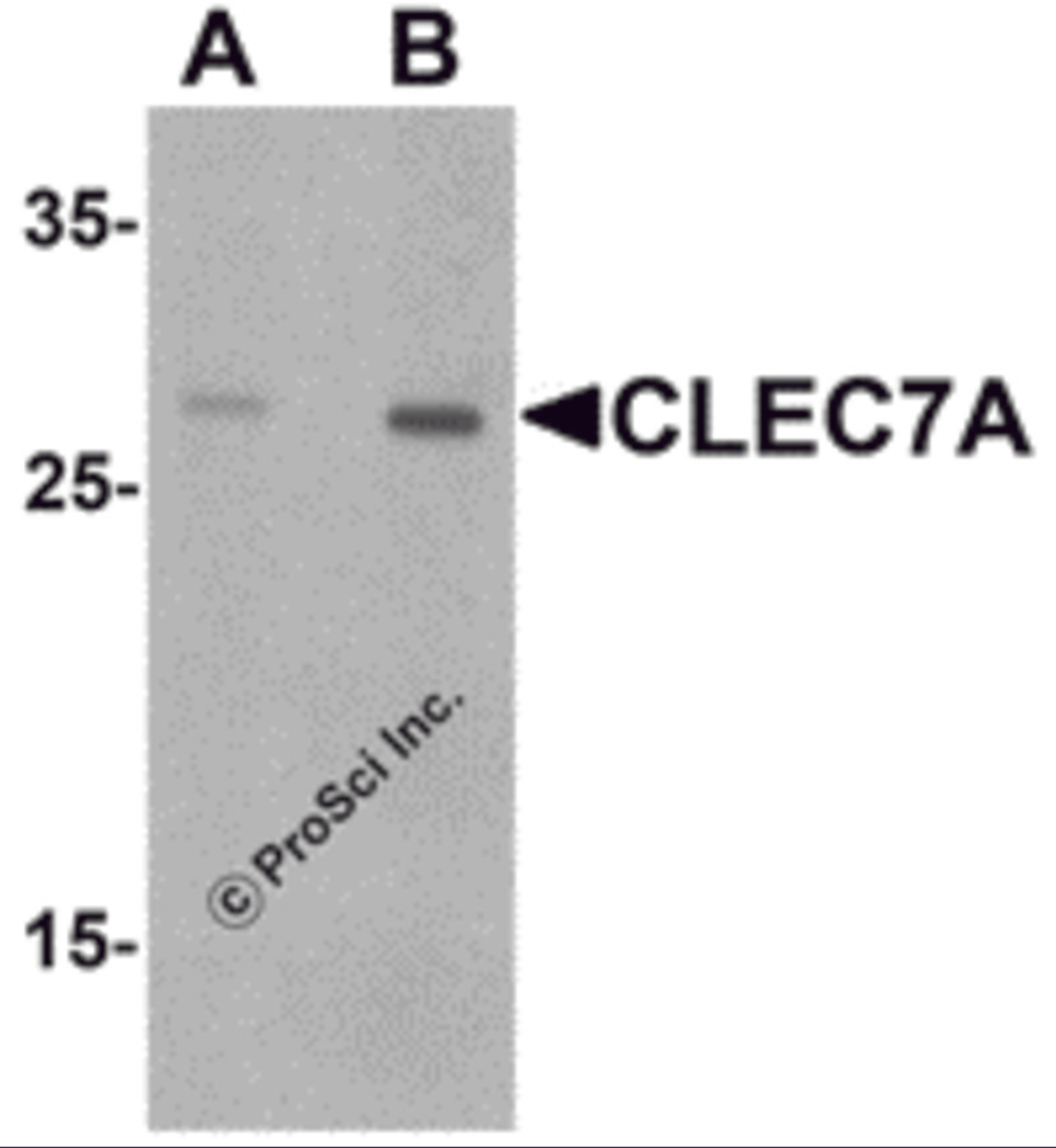 Western blot analysis of CLEC7A in rat spleen tissue lysate with CLEC7A antibody at (A) 1 and (B) 2 μg/mL.