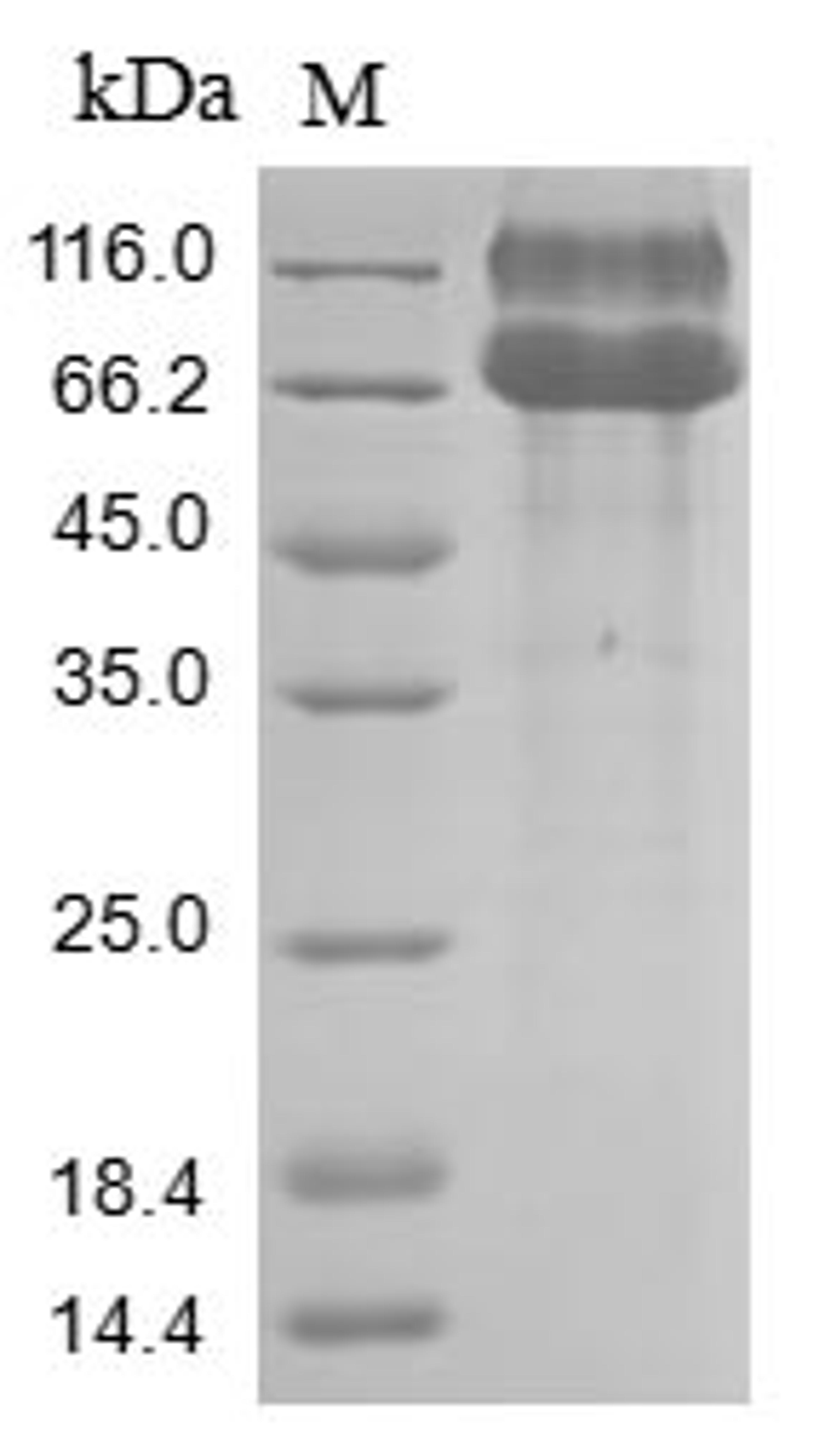 (Tris-Glycine gel) Discontinuous SDS-PAGE (reduced) with 5% enrichment gel and 15% separation gel.