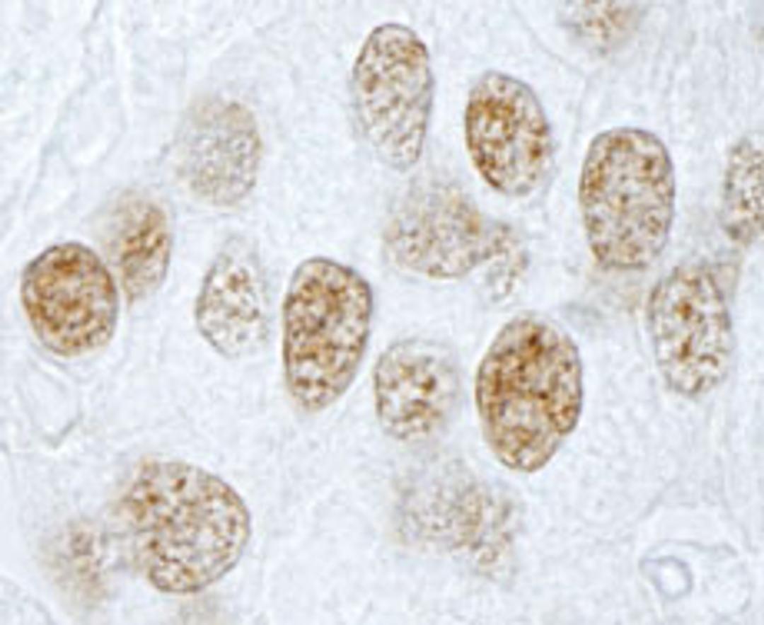 Detection of human PLRG1 by immunohistochemistry.