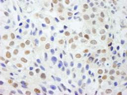 Detection of human DDX54 by immunohistochemistry.