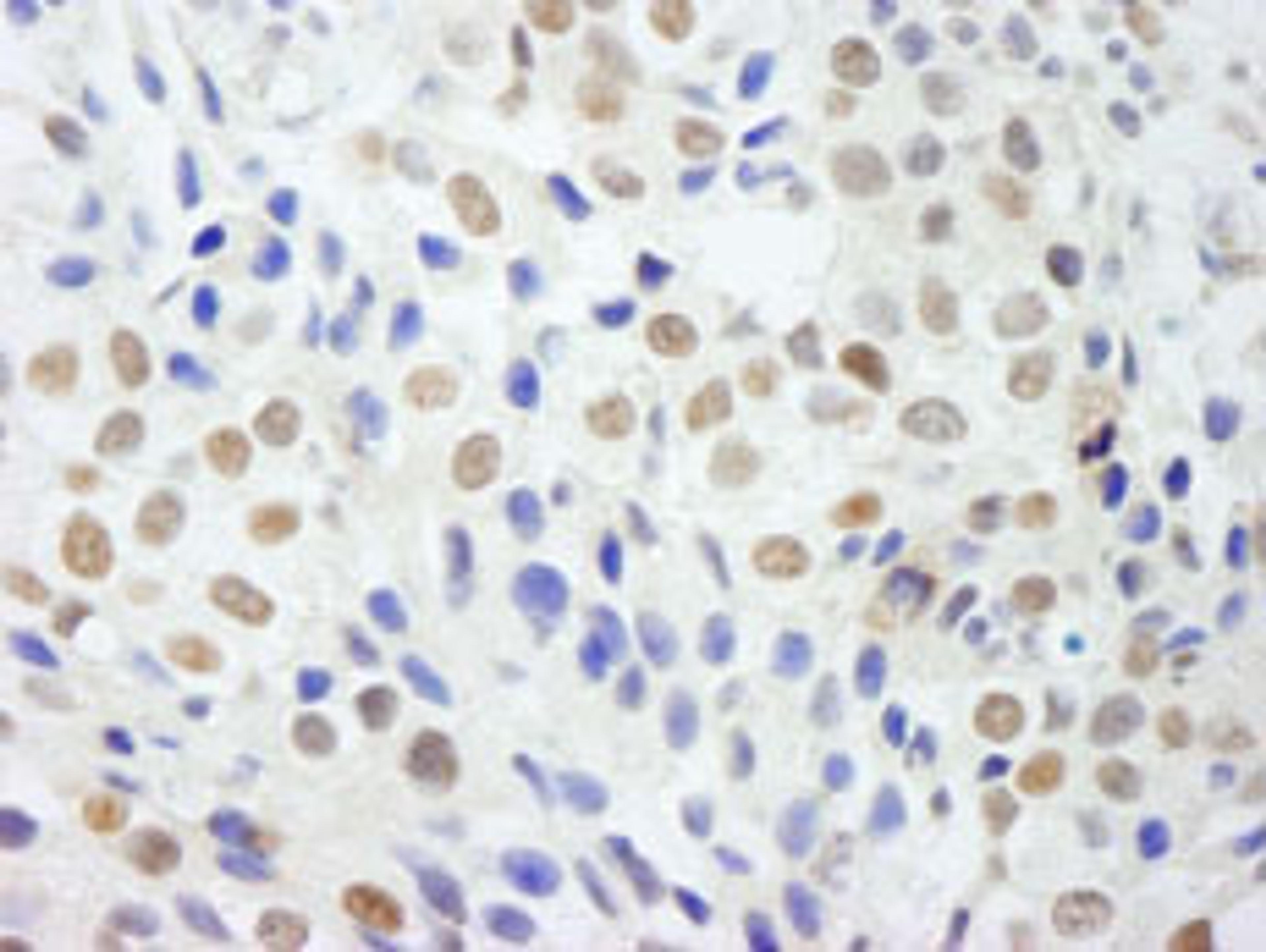 Detection of human DDX54 by immunohistochemistry.