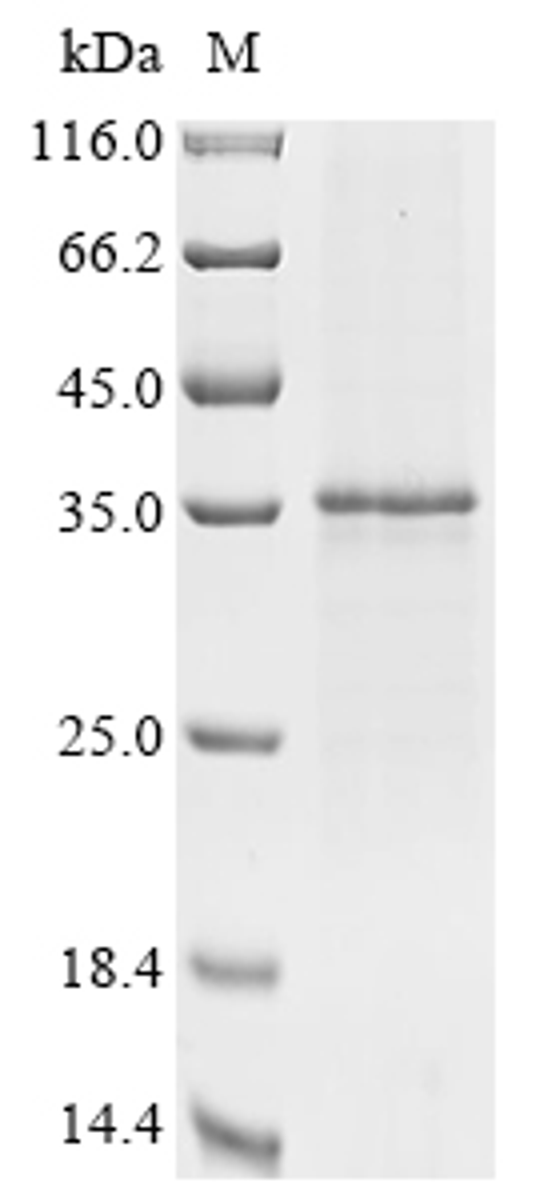 (Tris-Glycine gel) Discontinuous SDS-PAGE (reduced) with 5% enrichment gel and 15% separation gel.