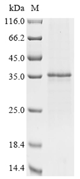 (Tris-Glycine gel) Discontinuous SDS-PAGE (reduced) with 5% enrichment gel and 15% separation gel.