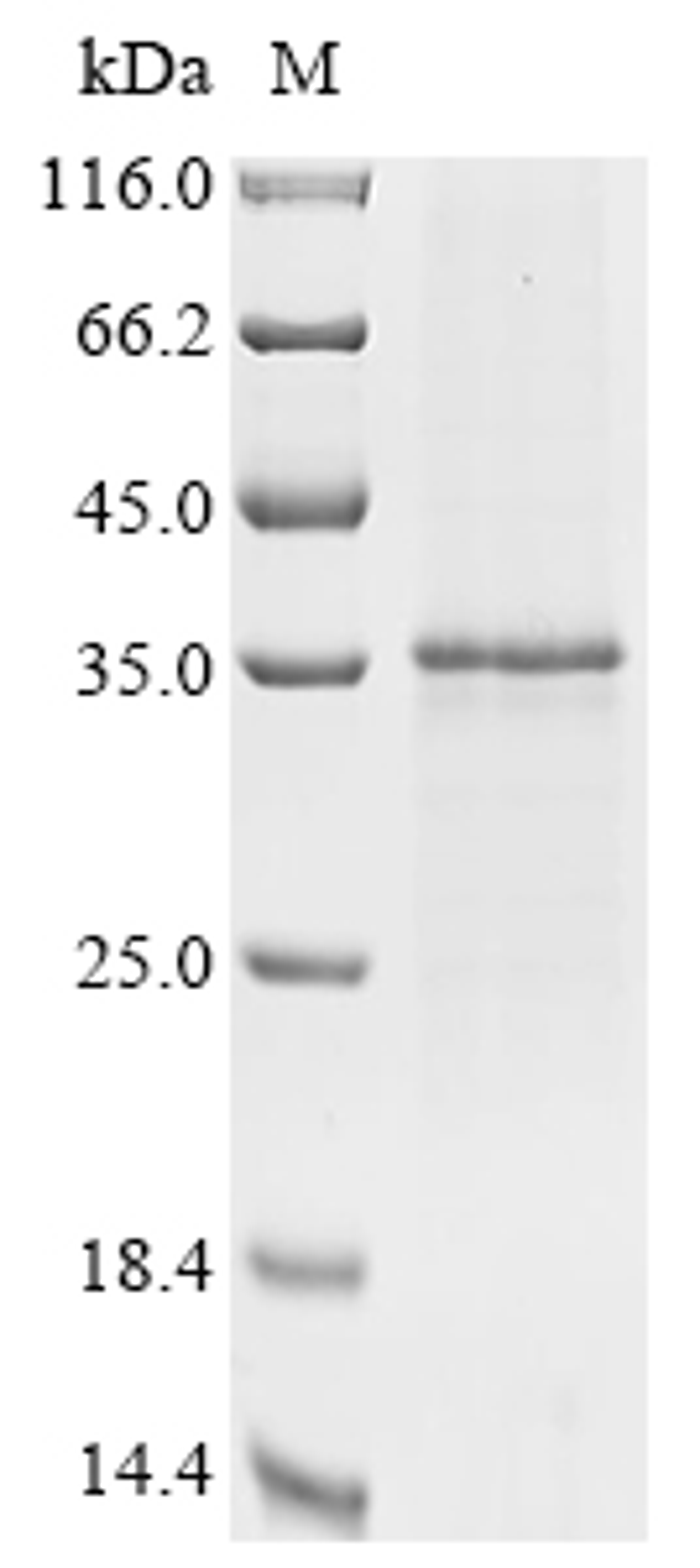 (Tris-Glycine gel) Discontinuous SDS-PAGE (reduced) with 5% enrichment gel and 15% separation gel.