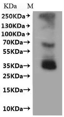 CSB-MP004847MO is detected by Mouse anti-6*His monoclonal antibody.