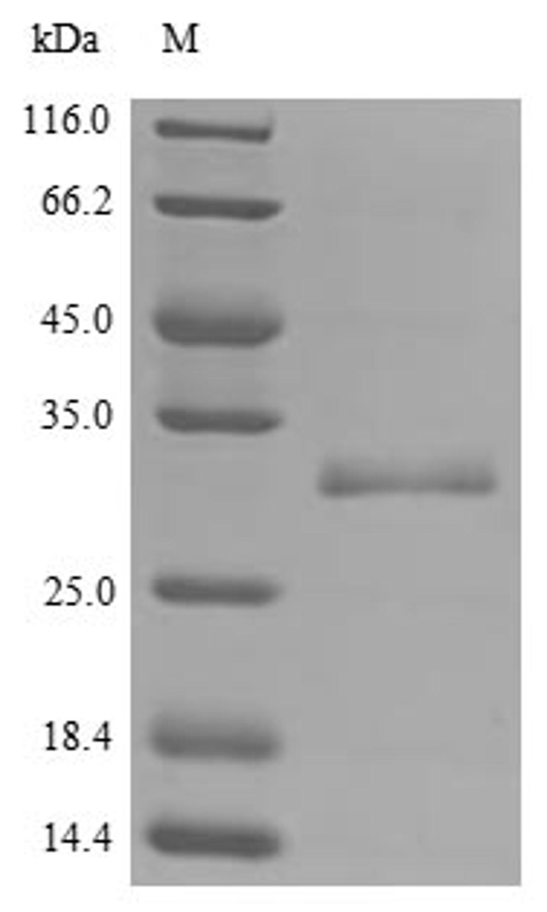 (Tris-Glycine gel) Discontinuous SDS-PAGE (reduced) with 5% enrichment gel and 15% separation gel.