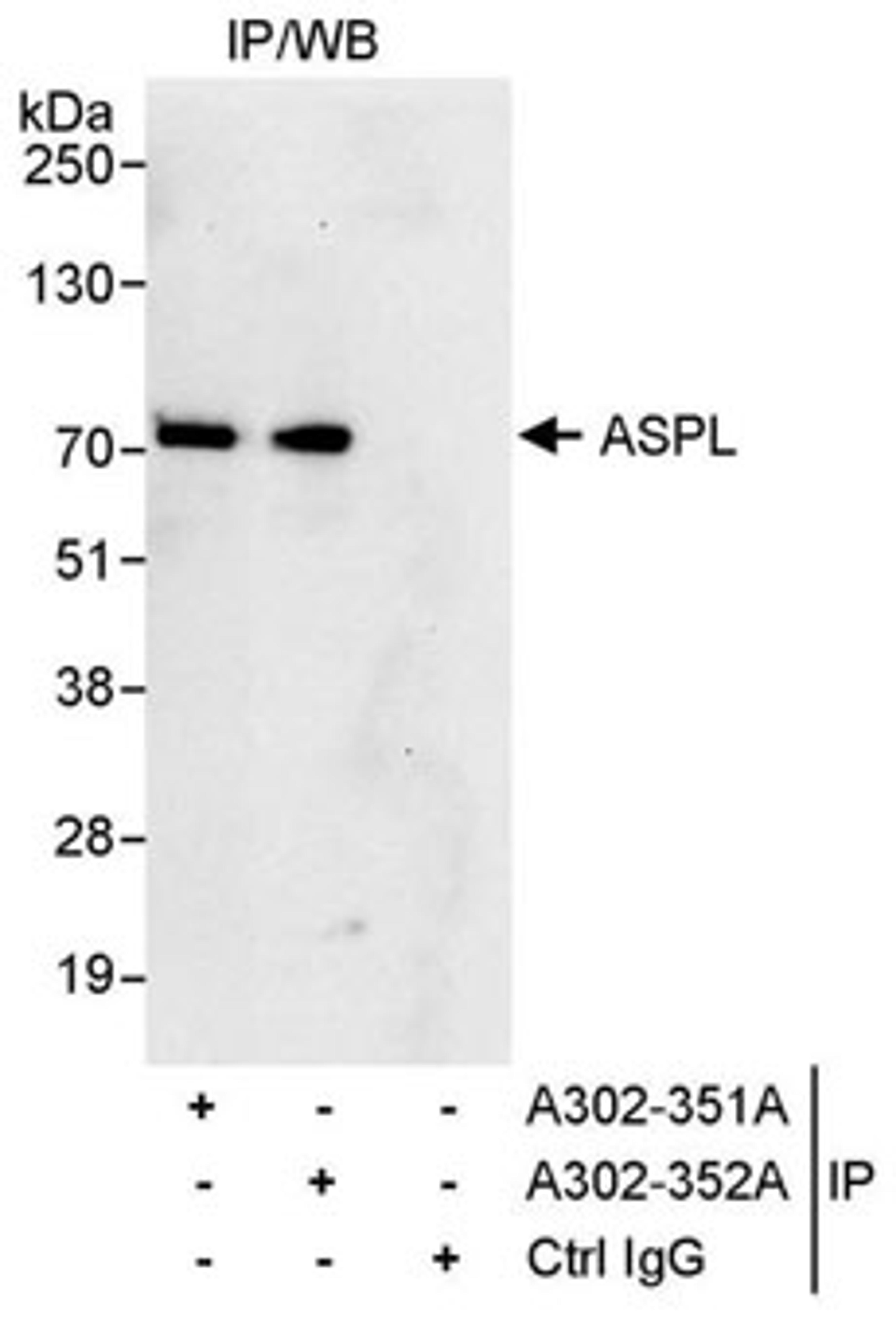 Detection of human ASPL by western blot of immunoprecipitates.