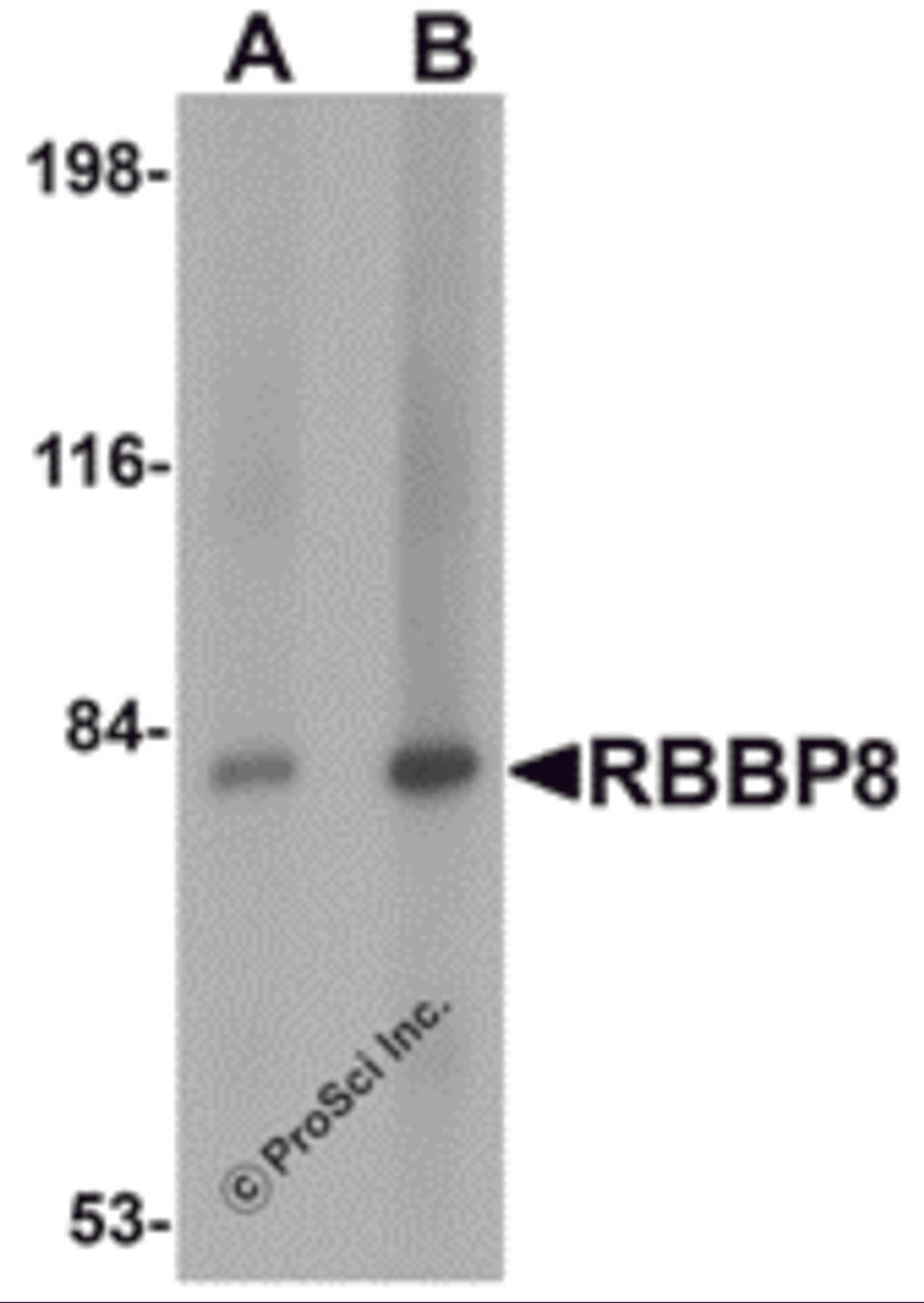 Western blot analysis of RBBP8 in mouse spleen tissue lysate with RBBP8 antibody at (A) 1 and (B) 2 μg/mL.