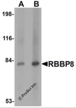 Western blot analysis of RBBP8 in mouse spleen tissue lysate with RBBP8 antibody at (A) 1 and (B) 2 μg/mL.