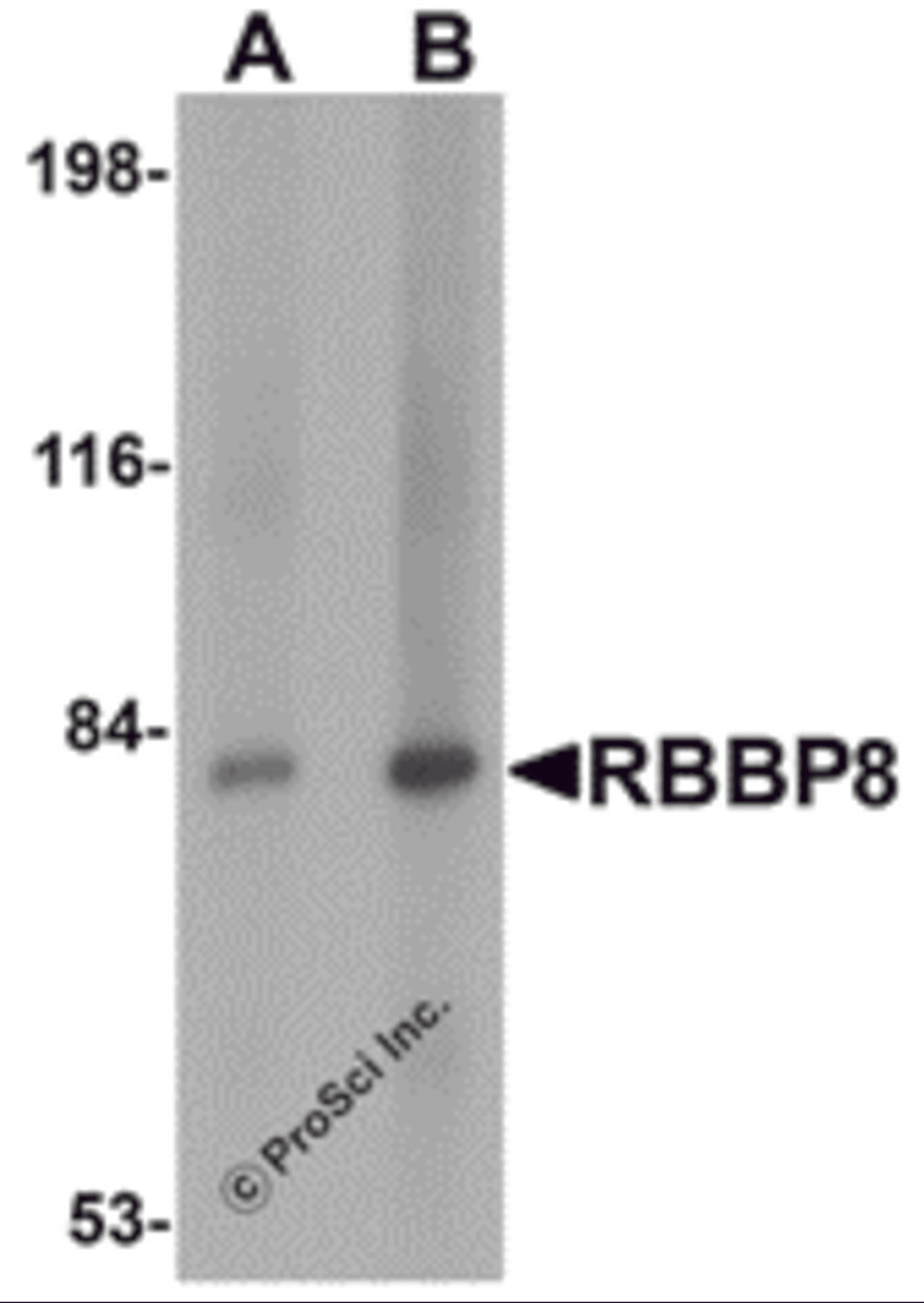 Western blot analysis of RBBP8 in mouse spleen tissue lysate with RBBP8 antibody at (A) 1 and (B) 2 μg/mL.