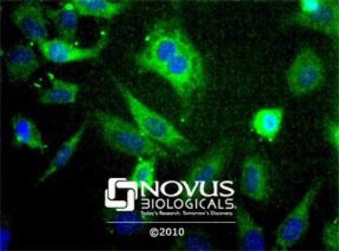 Immunocytochemistry/Immunofluorescence: SCD Antibody [NBP1-26393] - SCD staining in Hela cells detected with a Dylight 488 labeled secondary antibody (Green) with Hoechst 33258 nuclear counterstain (Blue).