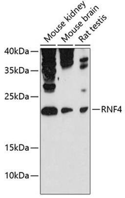 Western blot - RNF4 antibody (A12037)