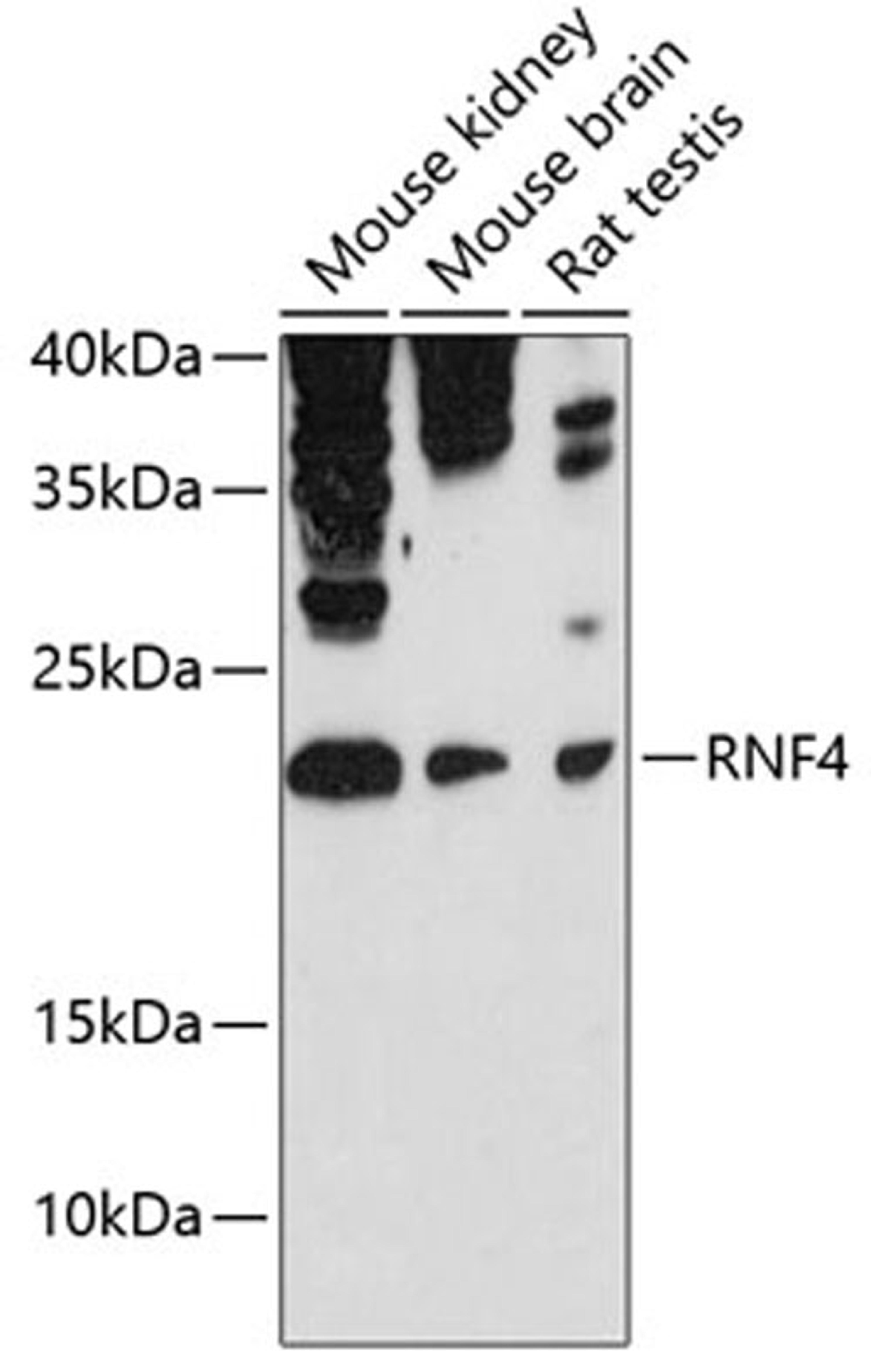 Western blot - RNF4 antibody (A12037)