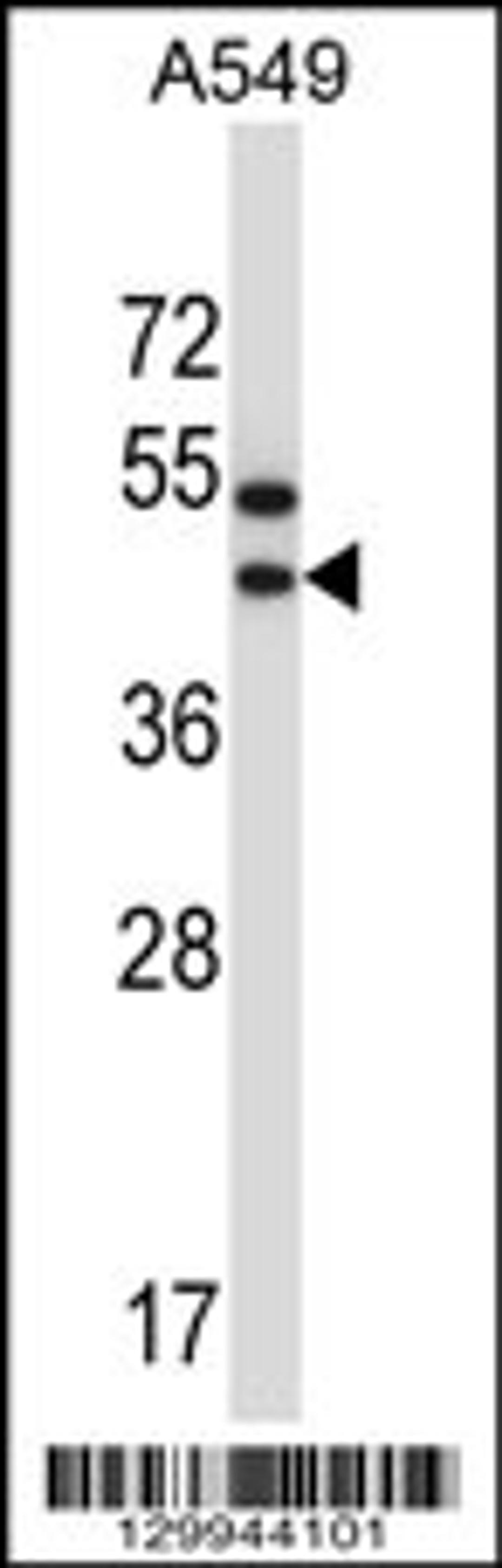 Western blot analysis in A549 cell line lysates (35ug/lane).