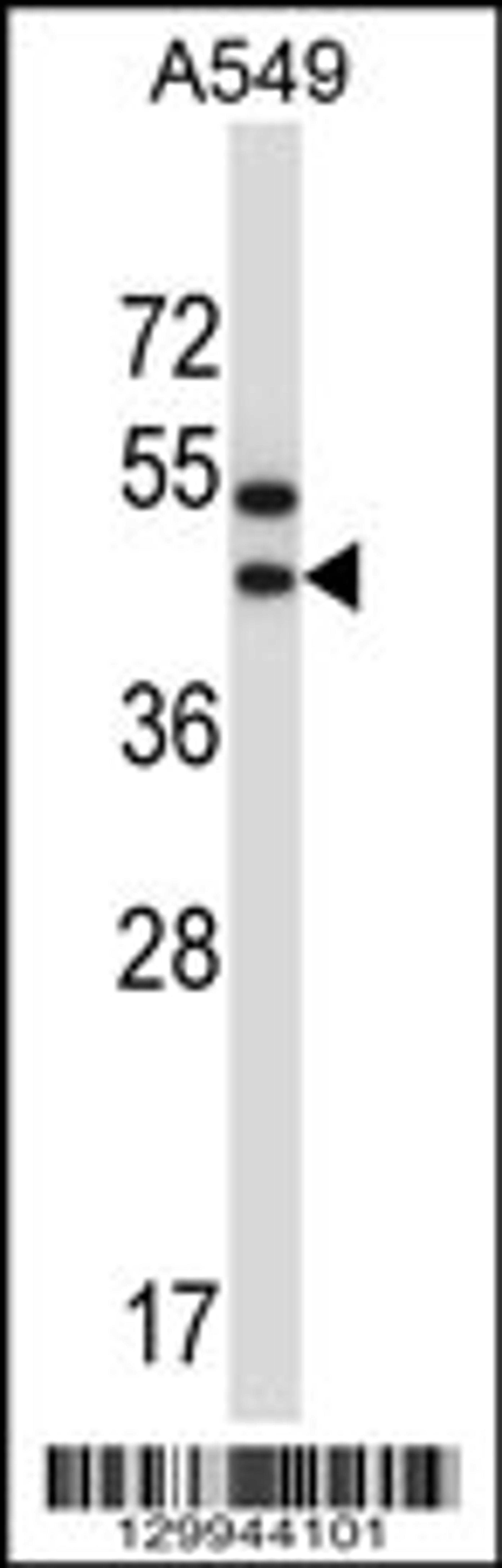 Western blot analysis in A549 cell line lysates (35ug/lane).