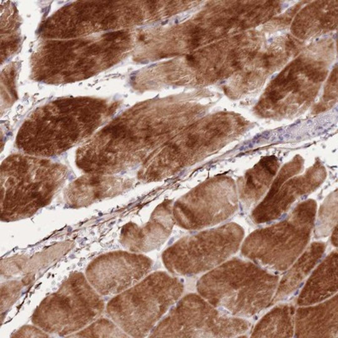 Immunohistochemistry-Paraffin: NKX2.3 Antibody [NBP2-13659] - Staining of human skeletal muscle shows strong cytoplasmic positivity in myocytes.