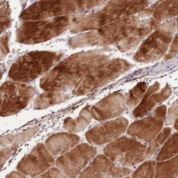 Immunohistochemistry-Paraffin: NKX2.3 Antibody [NBP2-13659] - Staining of human skeletal muscle shows strong cytoplasmic positivity in myocytes.