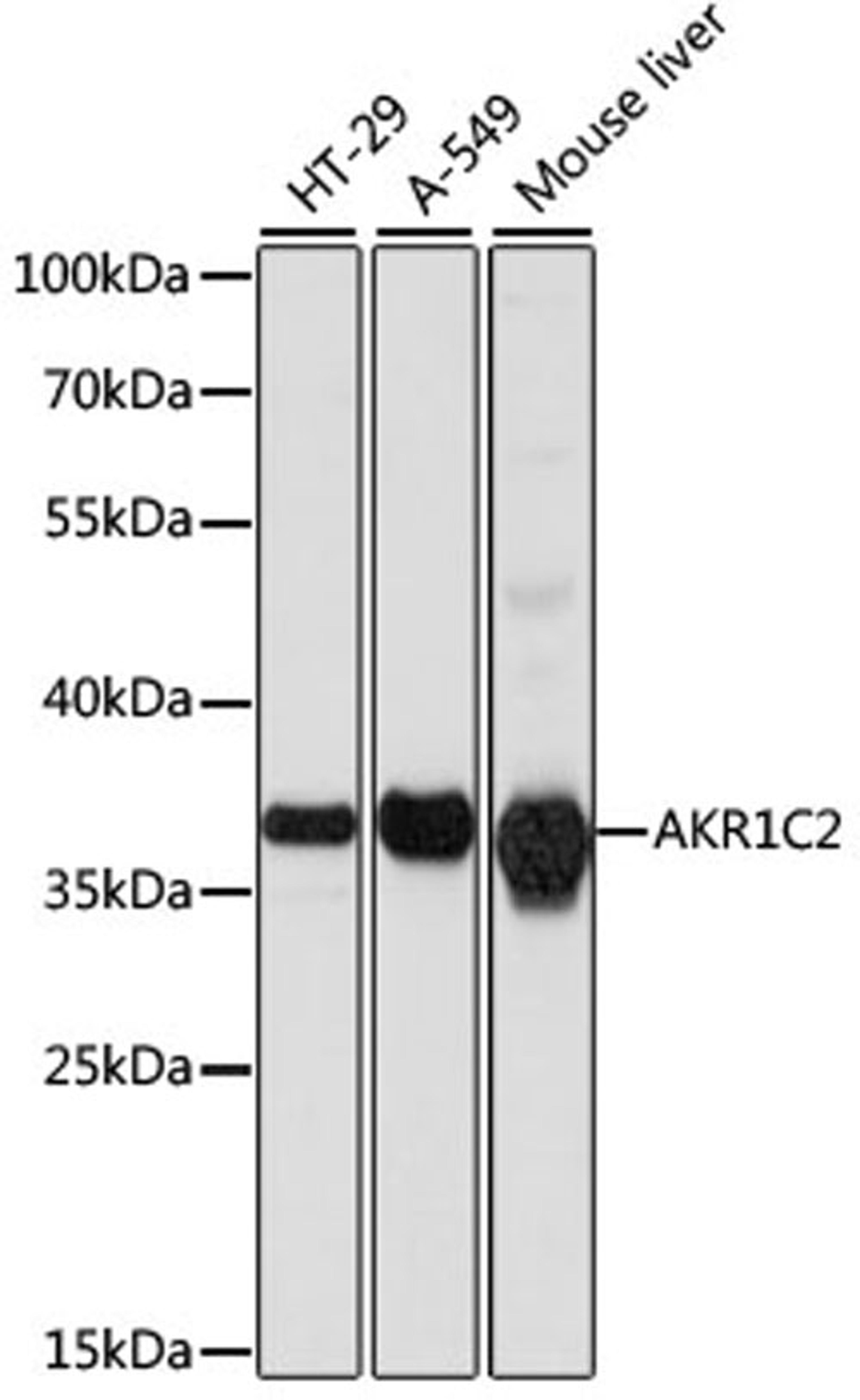 Western blot - AKR1C2 antibody (A1048)