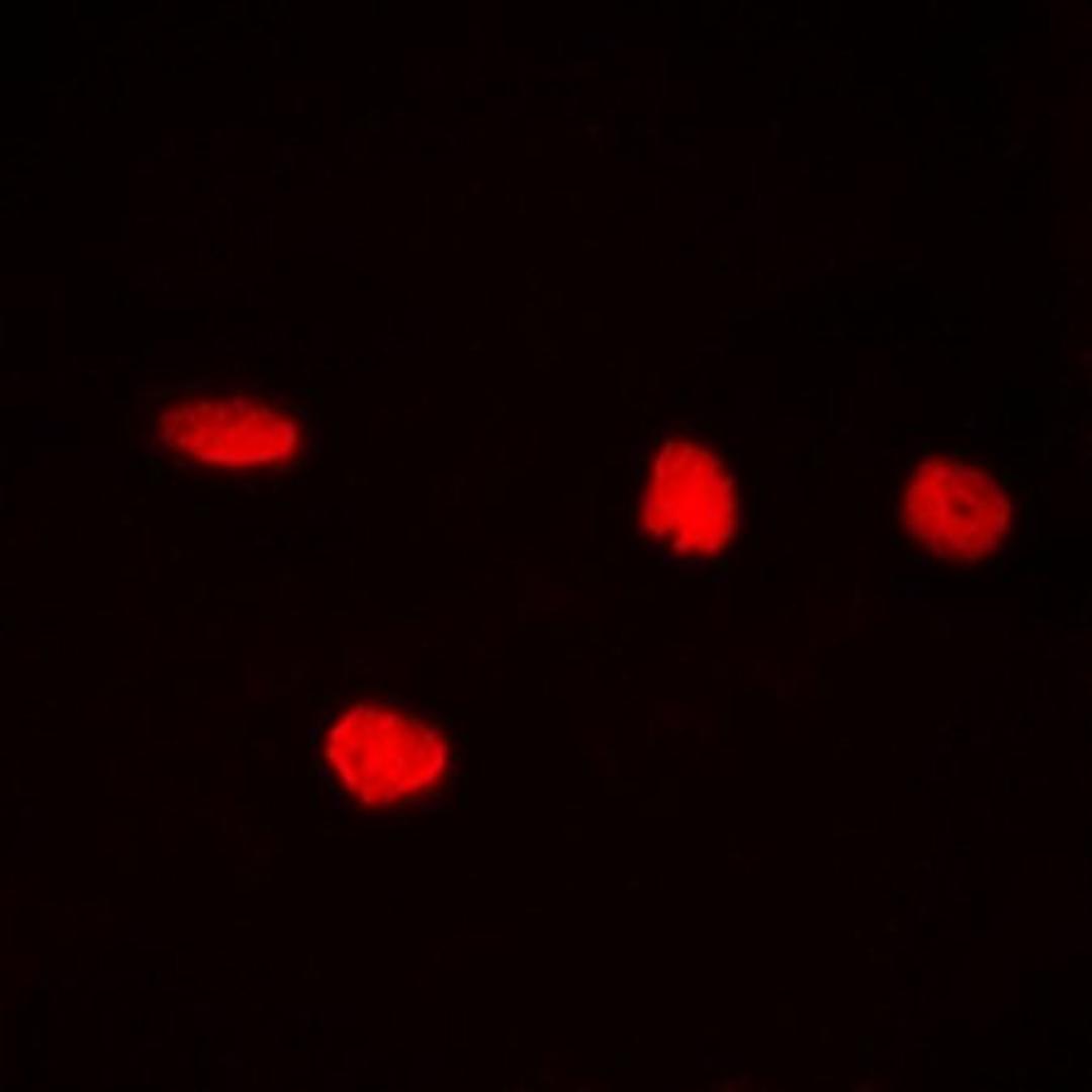 Immunofluorescense analysis of Hela cells using CDC25C (phospho-S216) antibody