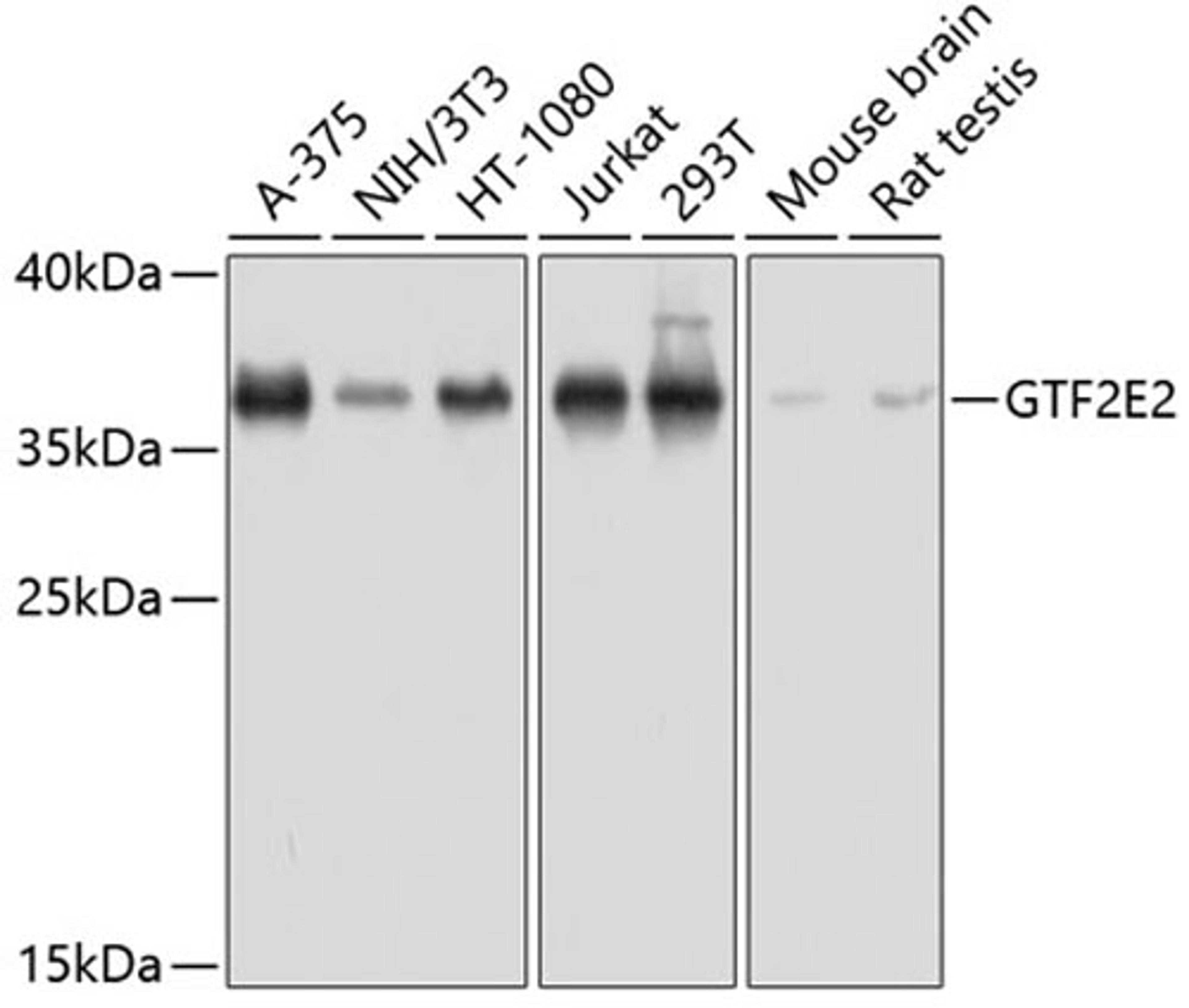 Western blot - GTF2E2 antibody (A8732)