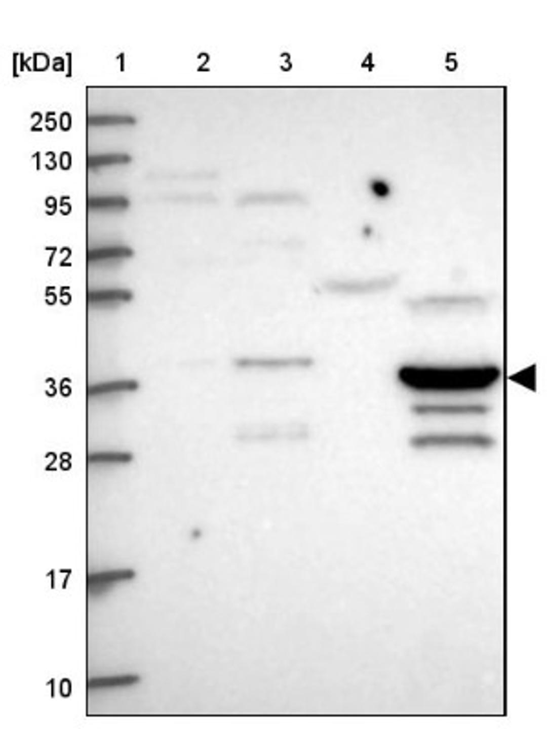 Western Blot: C5orf45 Antibody [NBP2-14417] - Lane 1: Marker [kDa] 250, 130, 95, 72, 55, 36, 28, 17, 10<br/>Lane 2: Human cell line RT-4<br/>Lane 3: Human cell line U-251MG sp<br/>Lane 4: Human plasma (IgG/HSA depleted)<br/>Lane 5: Human liver tissue