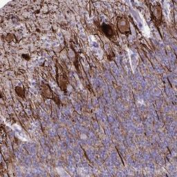 Immunohistochemistry: TMEM189 Antibody [NBP2-32476] - Staining of human cerebellum shows distinct positivity in processes.