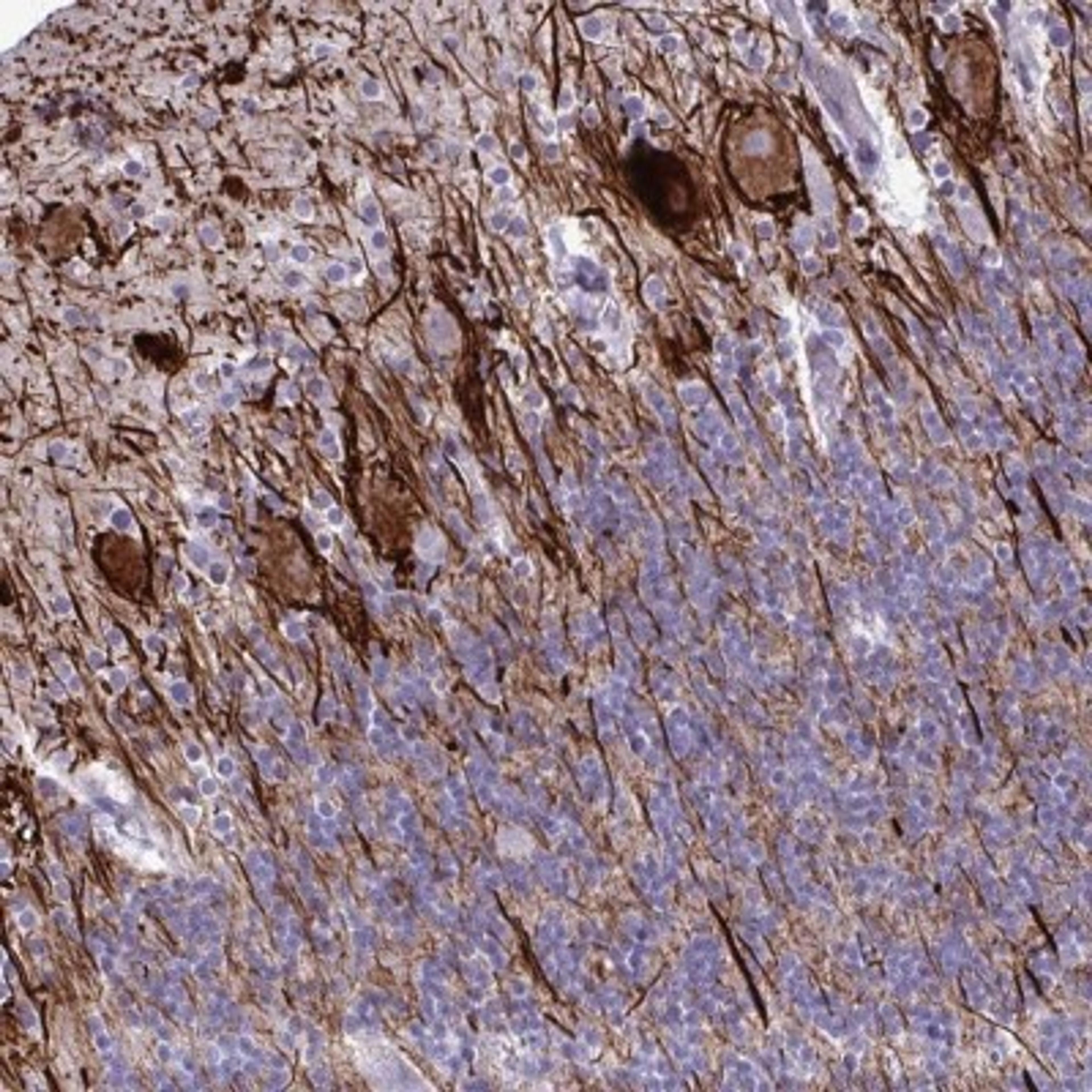 Immunohistochemistry: TMEM189 Antibody [NBP2-32476] - Staining of human cerebellum shows distinct positivity in processes.