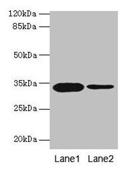 Western blot. All lanes: OGN antibody at 14µg/ml. Lane 1: Rat liver tissue. Lane 2: 293T whole cell lysate. Secondary. Goat polyclonal to rabbit IgG at 1/10000 dilution. Predicted band size: 34 kDa. Observed band size: 34 kDa
