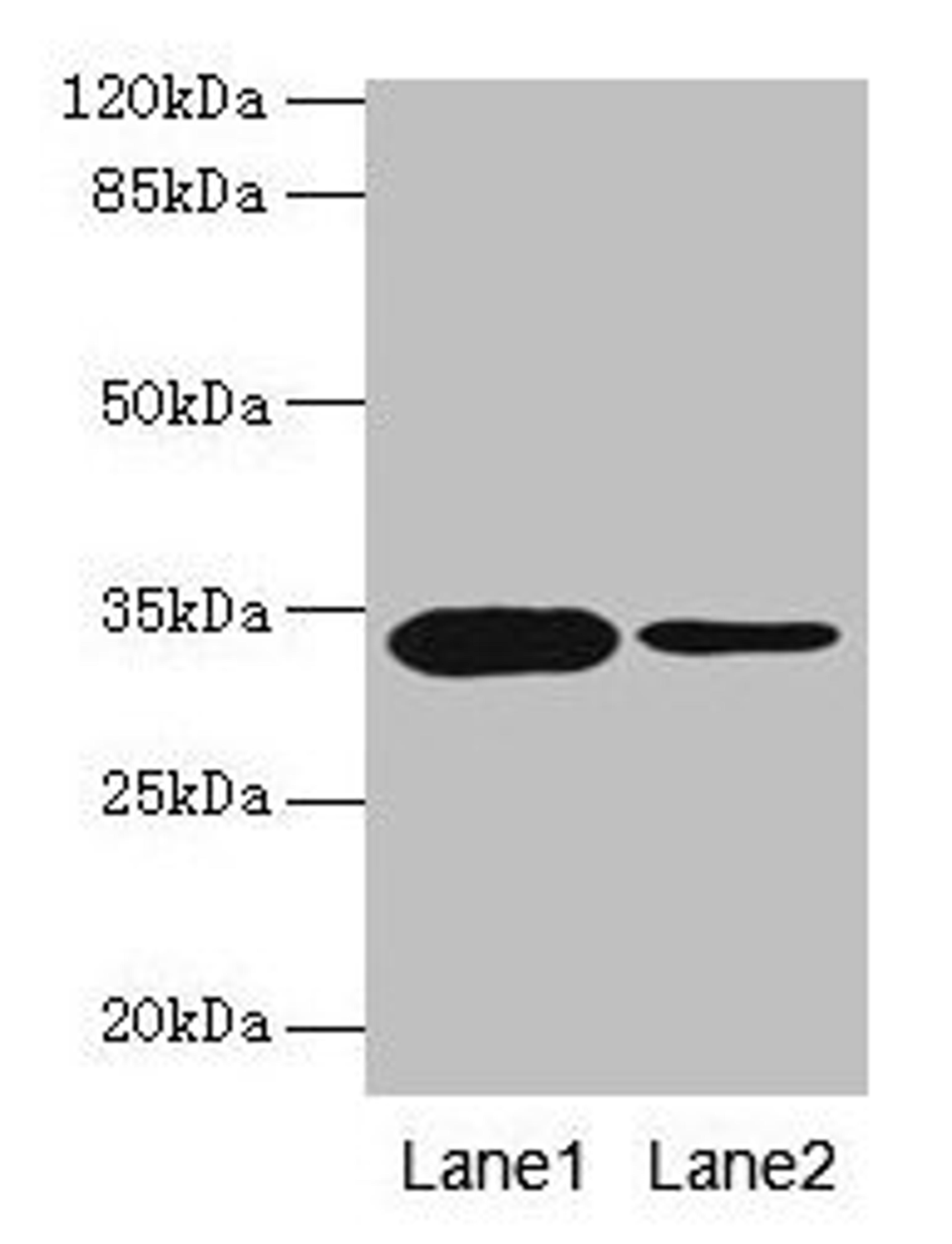 Western blot. All lanes: OGN antibody at 14µg/ml. Lane 1: Rat liver tissue. Lane 2: 293T whole cell lysate. Secondary. Goat polyclonal to rabbit IgG at 1/10000 dilution. Predicted band size: 34 kDa. Observed band size: 34 kDa