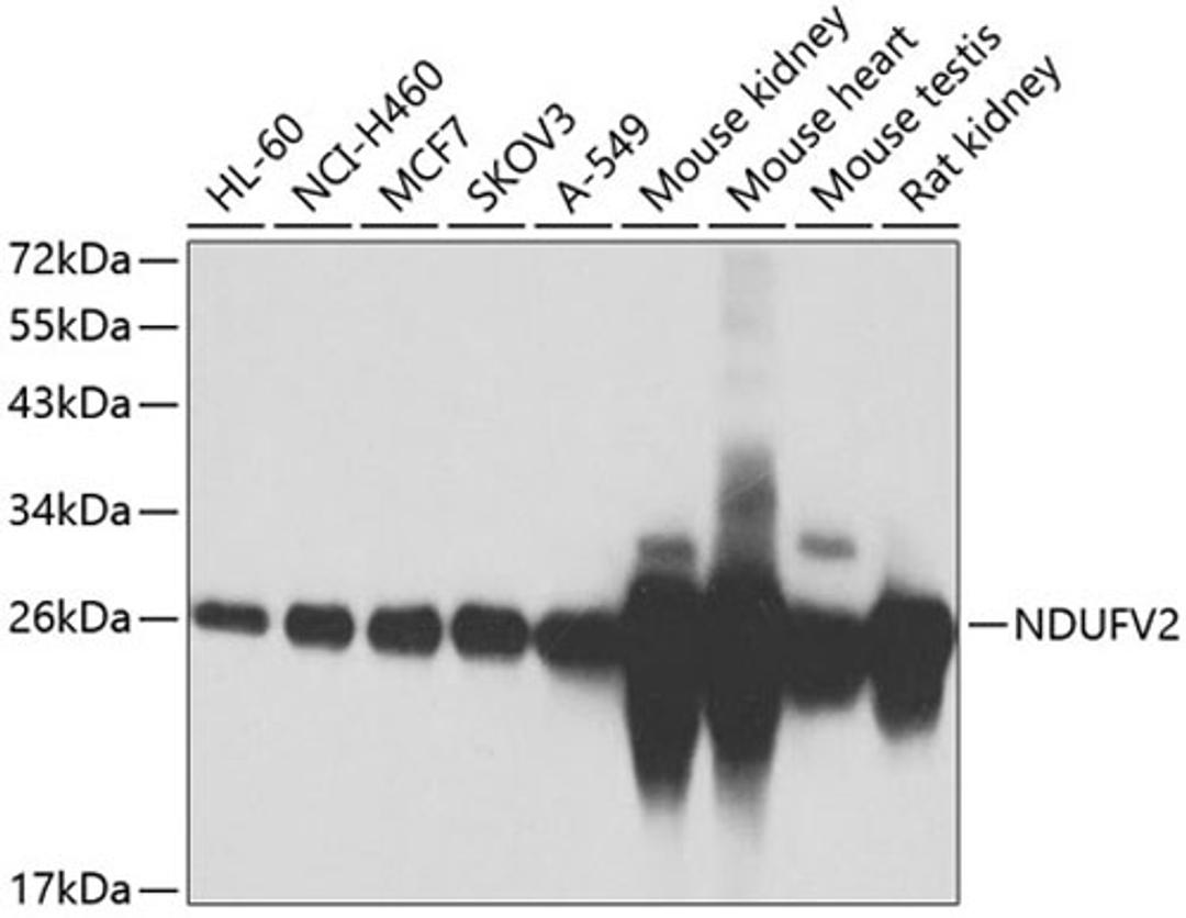 Western blot - NDUFV2 antibody (A7442)