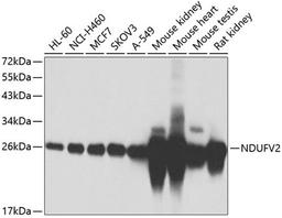 Western blot - NDUFV2 antibody (A7442)