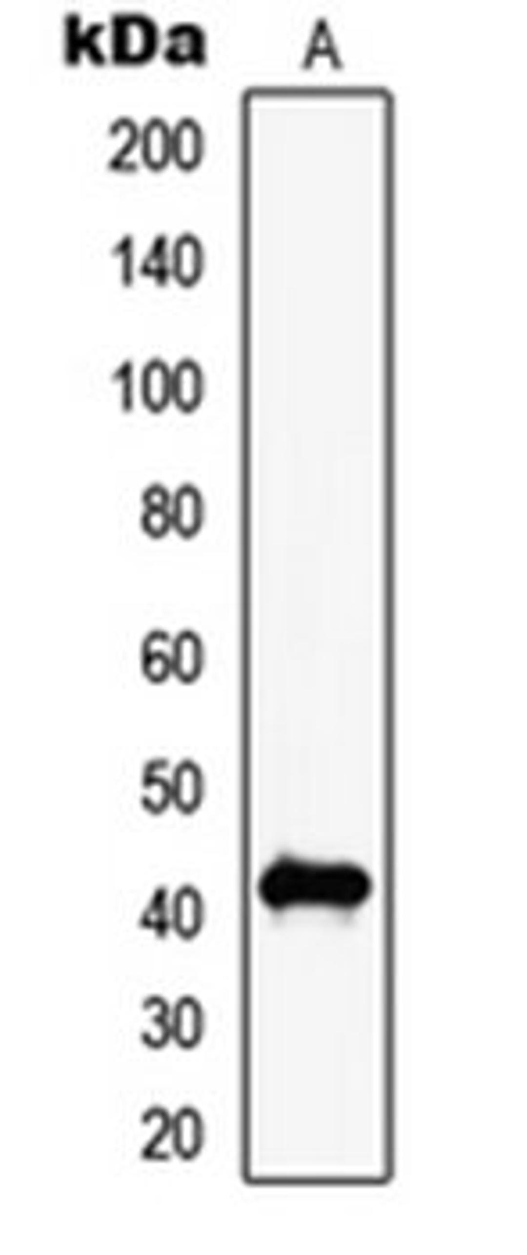 Western blot analysis of NIH3T3 (Lane 1) whole cell lysates using MAGEC2 antibody