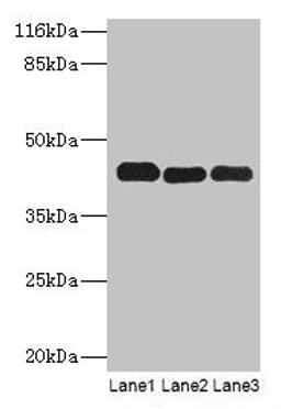 Western blot. All lanes: PPME1 antibody at 2µg/ml. Lane 1: A549 whole cell lysate. Lane 2: Hela whole cell lysate. Lane 3: Mouse brain tissue. Secondary. Goat polyclonal to rabbit IgG at 1/10000 dilution. Predicted band size: 43, 23, 19, 44 kDa. Observed band size: 43 kDa