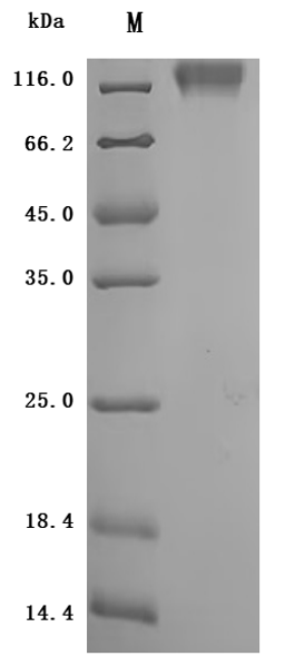 (Tris-Glycine gel) Discontinuous SDS-PAGE (reduced) with 5% enrichment gel and 15% separation gel.