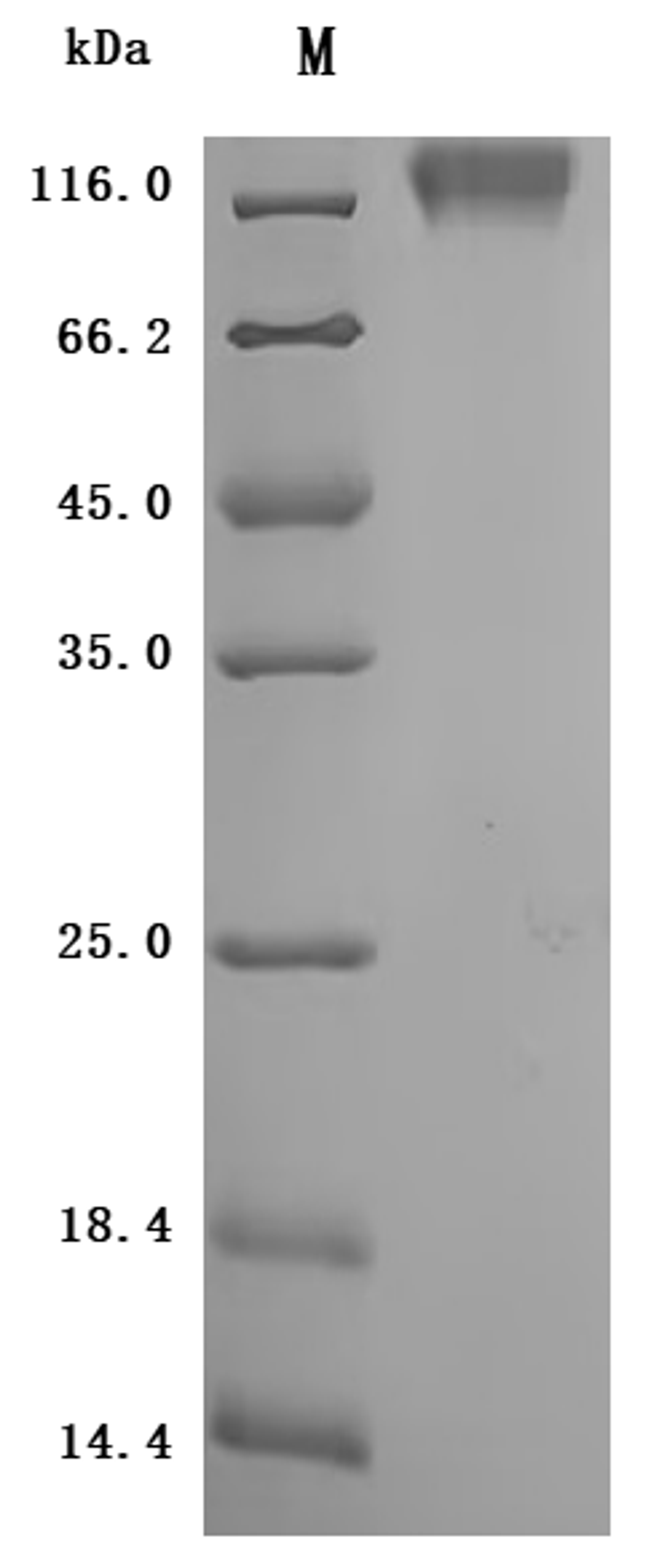 (Tris-Glycine gel) Discontinuous SDS-PAGE (reduced) with 5% enrichment gel and 15% separation gel.