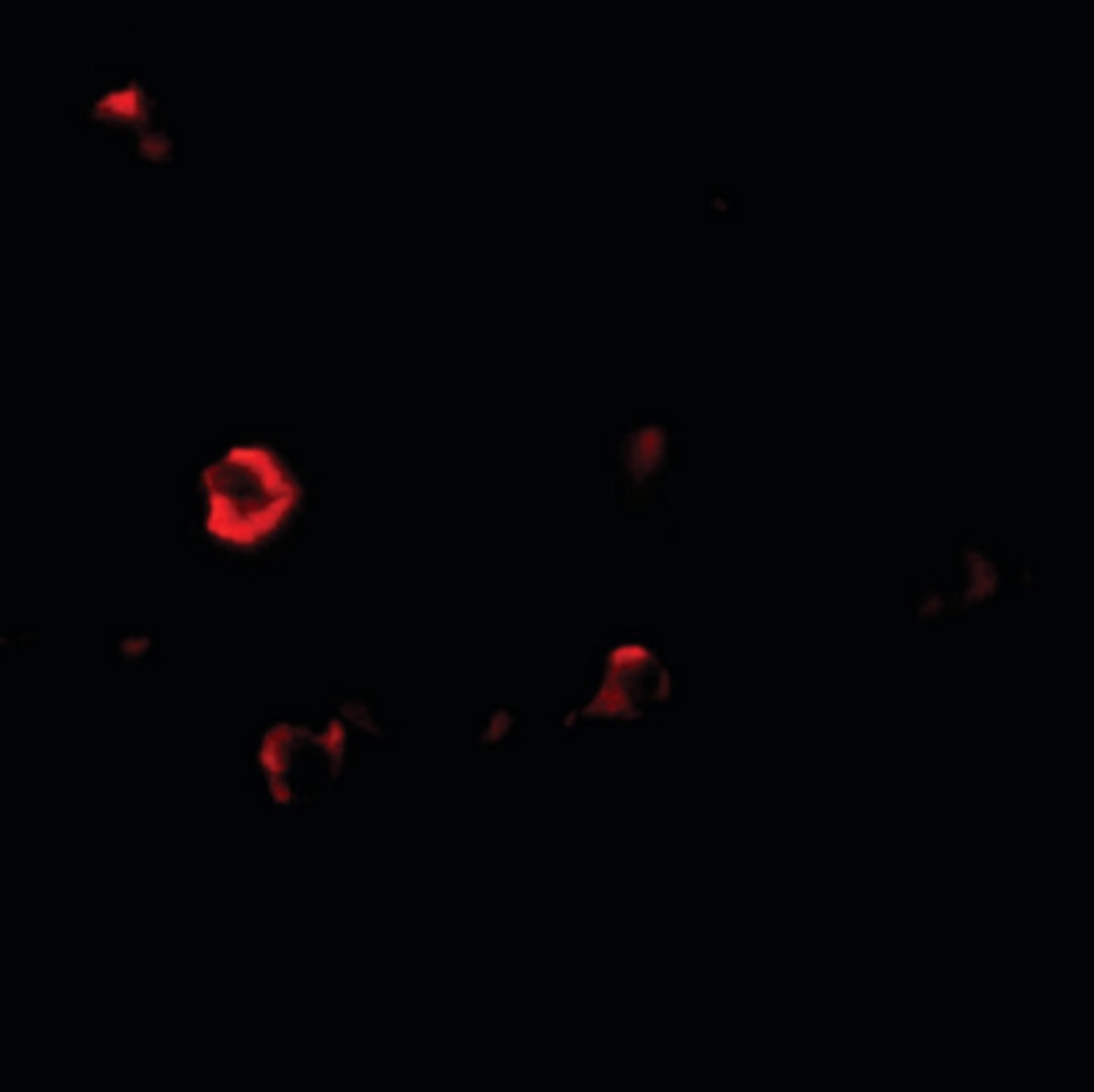 Immunofluorescence analysis of human small intestine tissue using IL1RL2 antibody