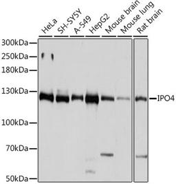 Western blot - IPO4 antibody (A15600)