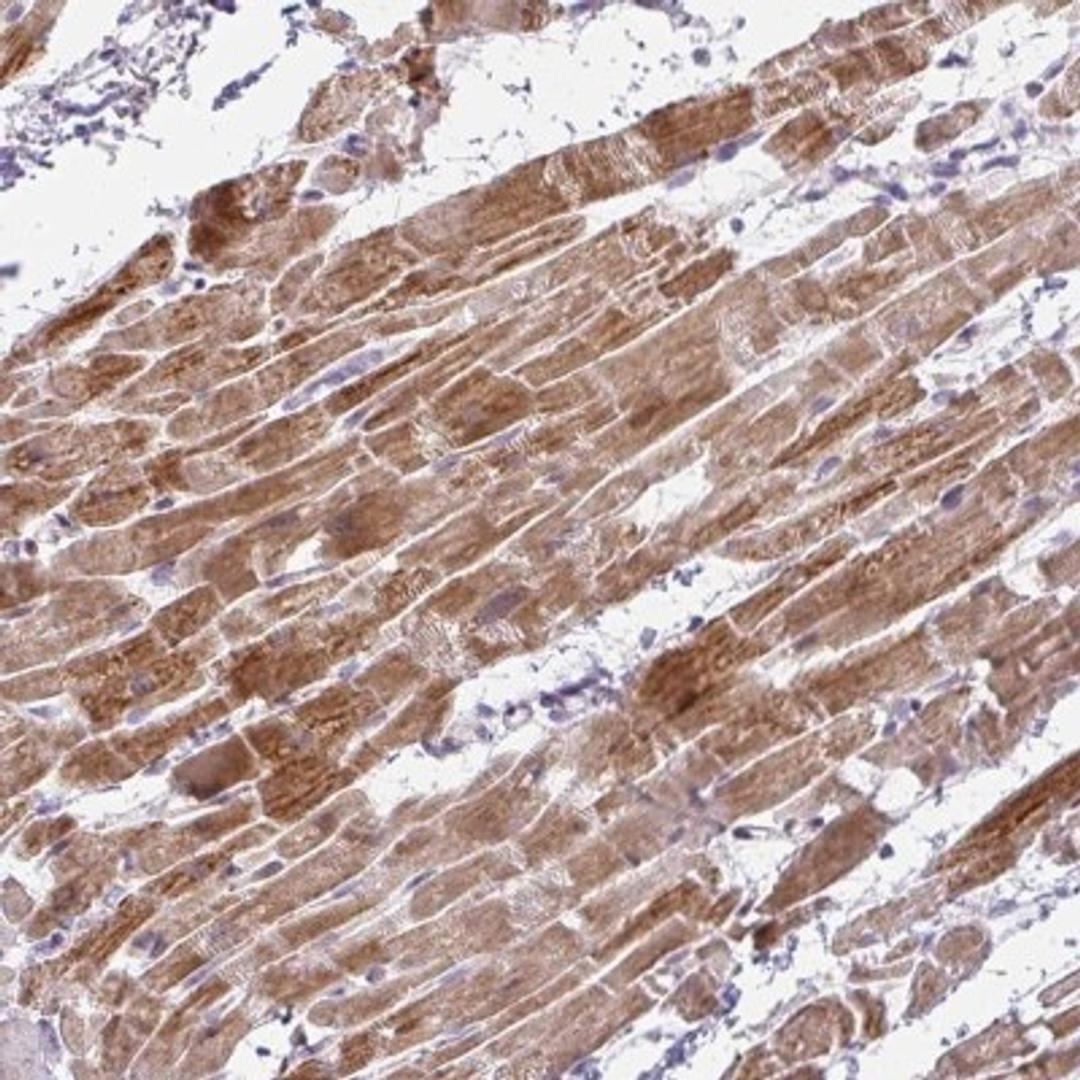 Immunohistochemistry: Secretory phospholipase A2 Type V Antibody [NBP2-31558] - Immunohistochemical staining of human heart muscle shows strong cytoplasmic positivity in myocytes.