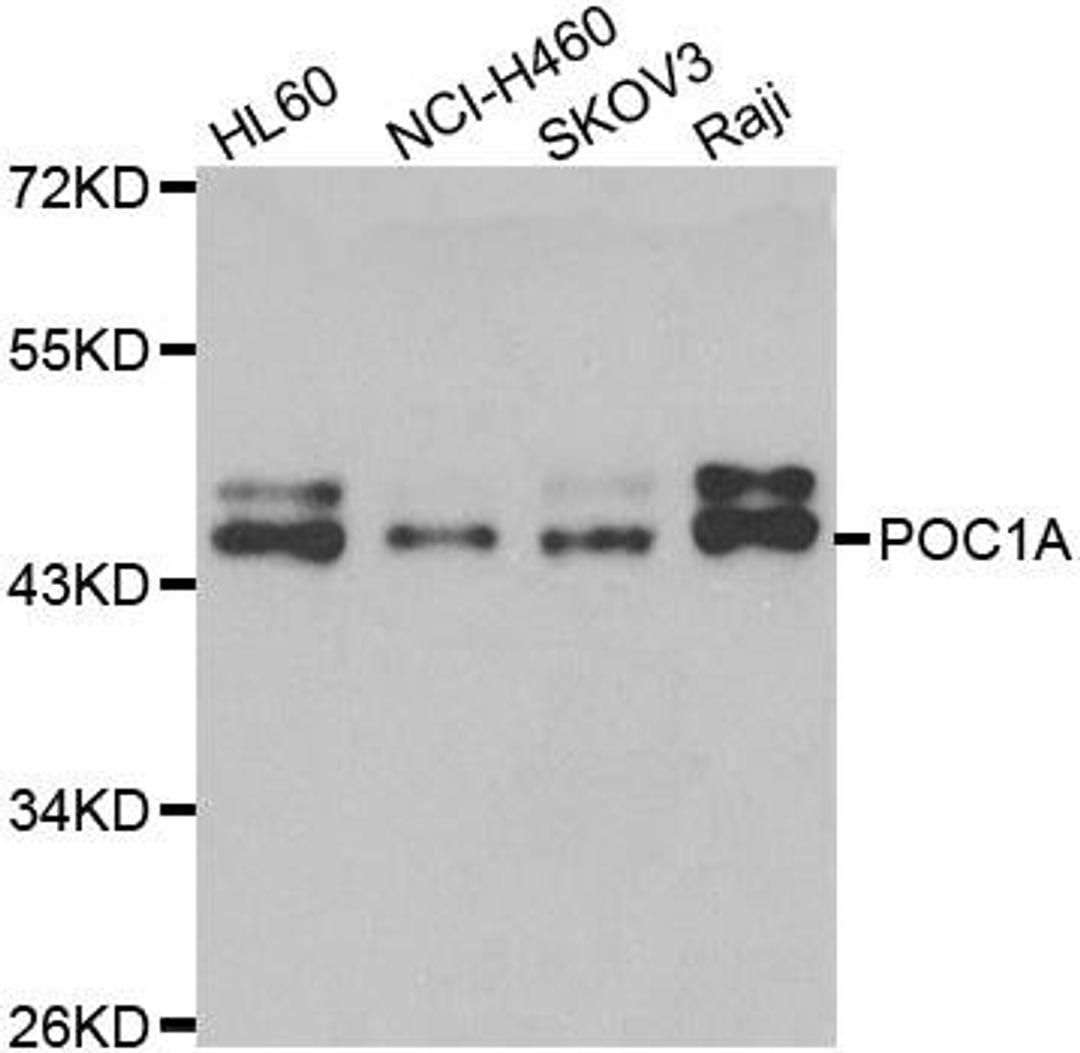 Western blot analysis of extracts of various cell lines using POC1A antibody