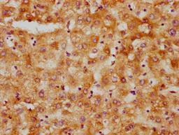 IHC image of CSB-PA010566LA01HU diluted at 1:500 and staining in paraffin-embedded human liver tissue performed on a Leica BondTM system. After dewaxing and hydration, antigen retrieval was mediated by high pressure in a citrate buffer (pH 6.0). Section was blocked with 10% normal goat serum 30min at RT. Then primary antibody (1% BSA) was incubated at 4°C overnight. The primary is detected by a biotinylated secondary antibody and visualized using an HRP conjugated SP system.