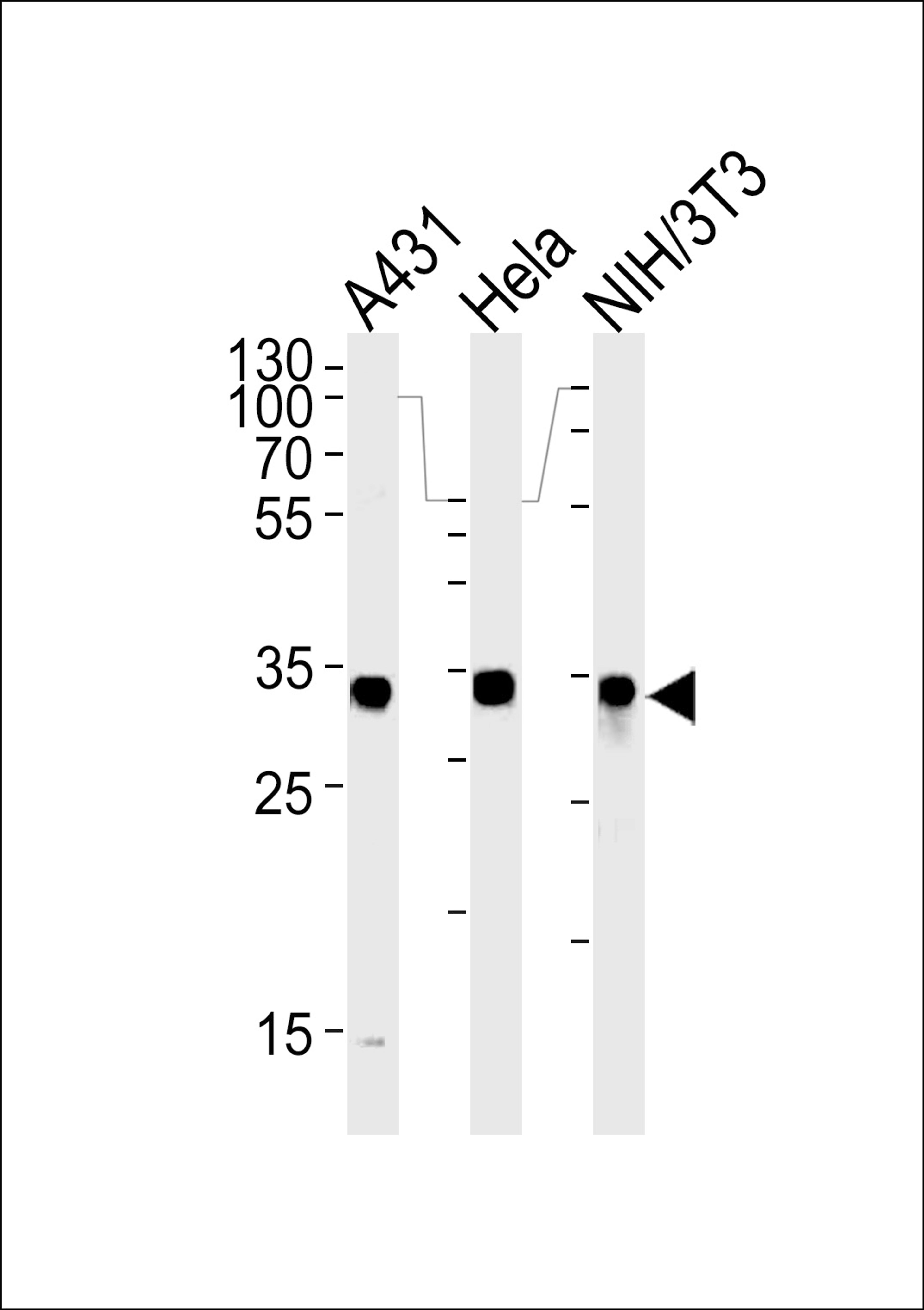 Western blot analysis in A431,Hela and mouse NIH/3T3 cell line lysates (35ug/lane).