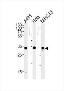 Western blot analysis in A431,Hela and mouse NIH/3T3 cell line lysates (35ug/lane).