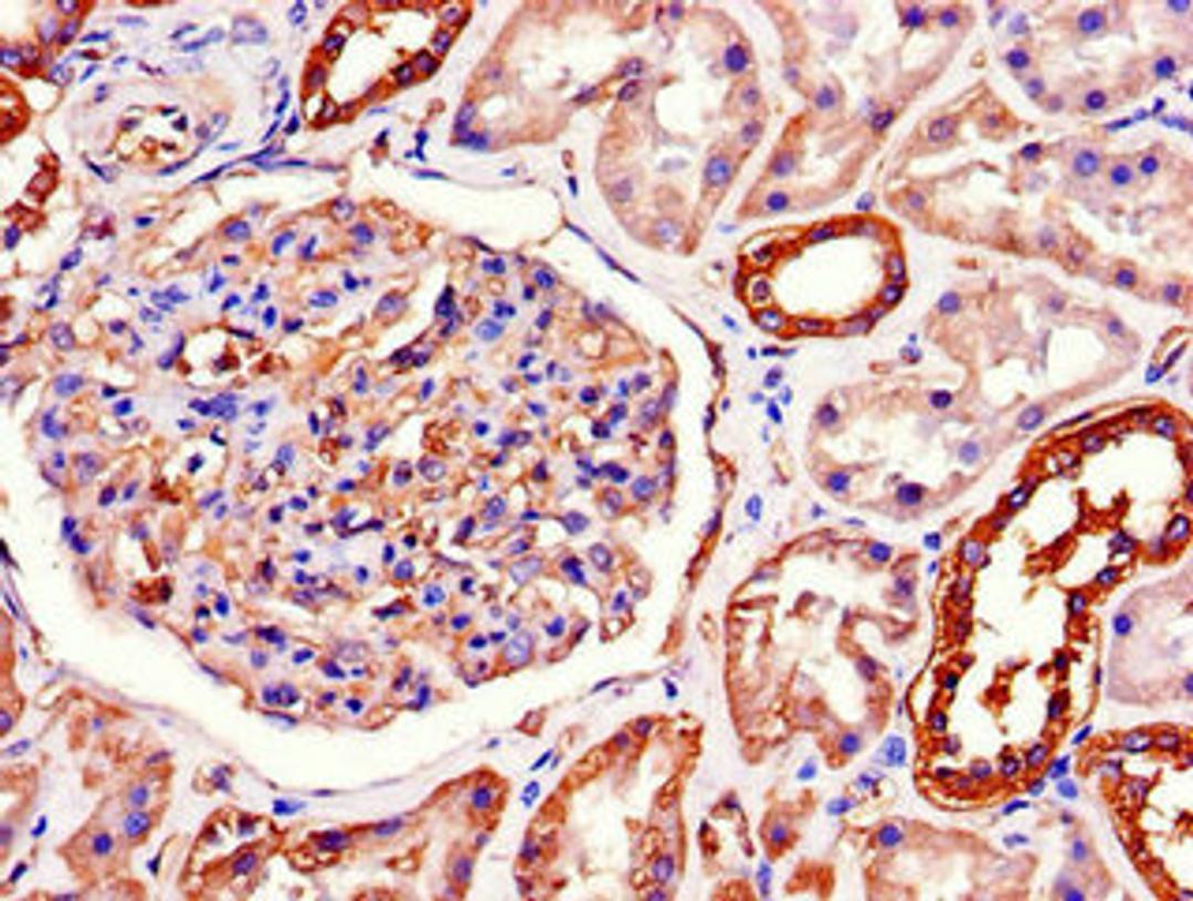 Immunohistochemistry of paraffin-embedded human kidney tissue using CSB-PA18129A0Rb at dilution of 1:100